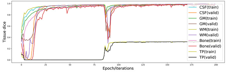 Getting proper class predictions in multi-class segmentation - PyTorch ...